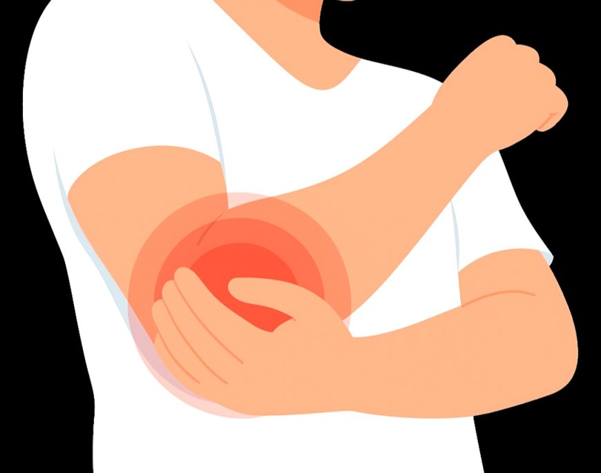 GEJALA, PENYEBAB DAN PENANGANGAN TENNIS ELBOW